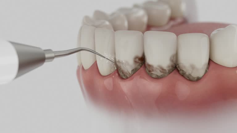Trusted Invisalign Clear Aligners service in Brockton, MA - Dentist Open Now